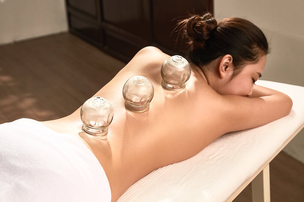 Young women in TCM cupping therapy
